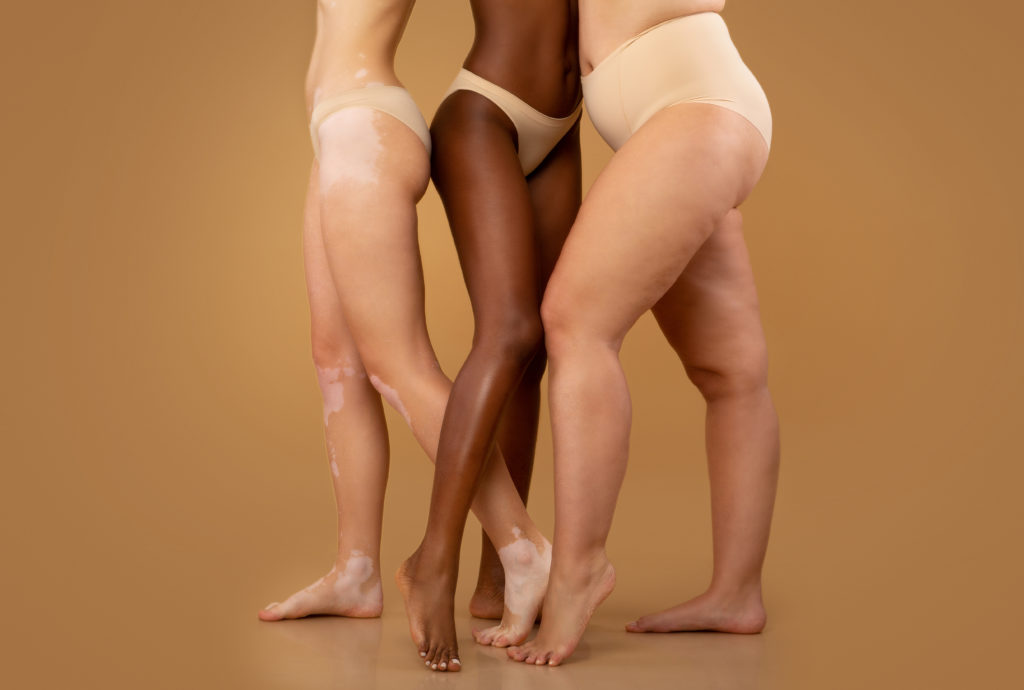 Every,Body,Is,Beautiful.,Tree,Women,With,Different,Race,And